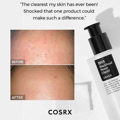 COSRX BHA Tonik – tisztító tonik problémás bőrre